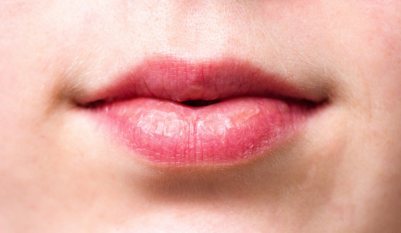 All you need to know about chapped lips according to Ayurveda