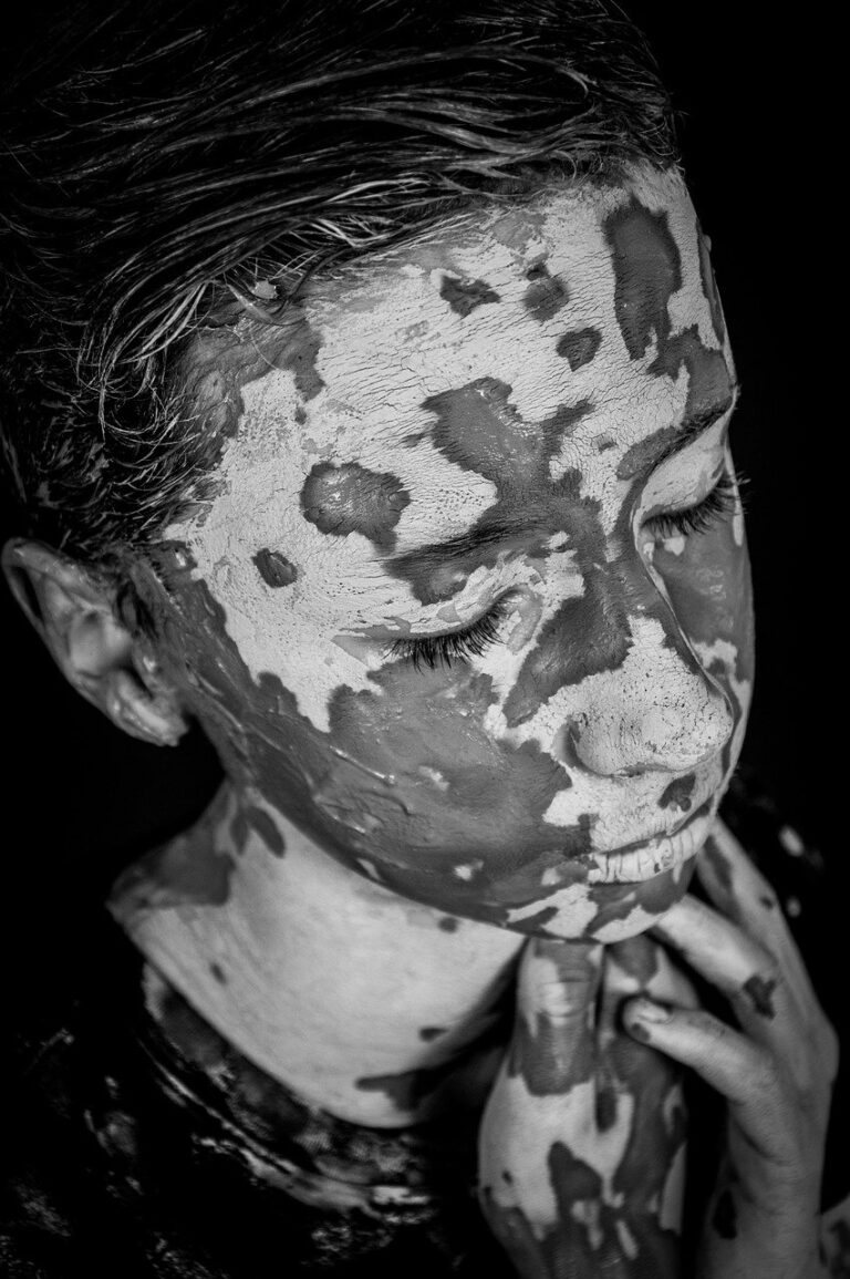 teen, model, skin-7791886.jpg